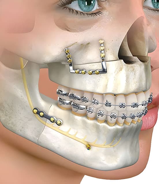 affordable jaw surgery in Albania