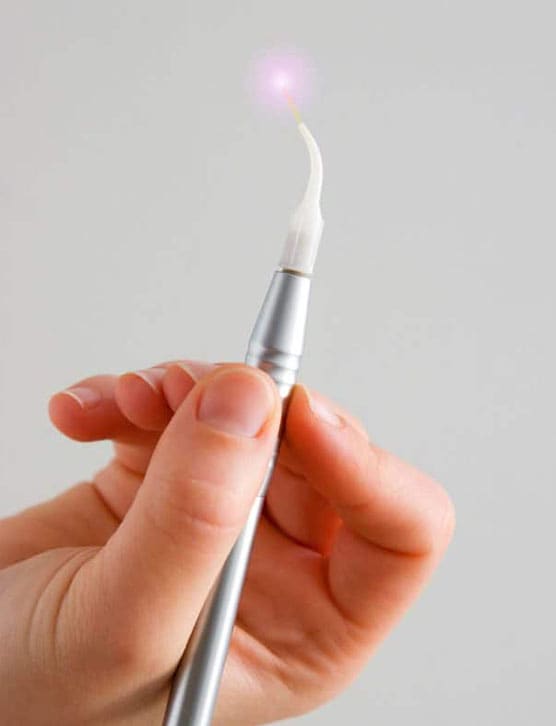 affordable laser dentistry in Albania