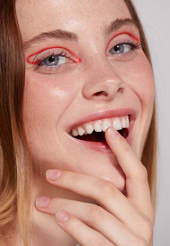 beautiful smile transformation after gum lift in Albania