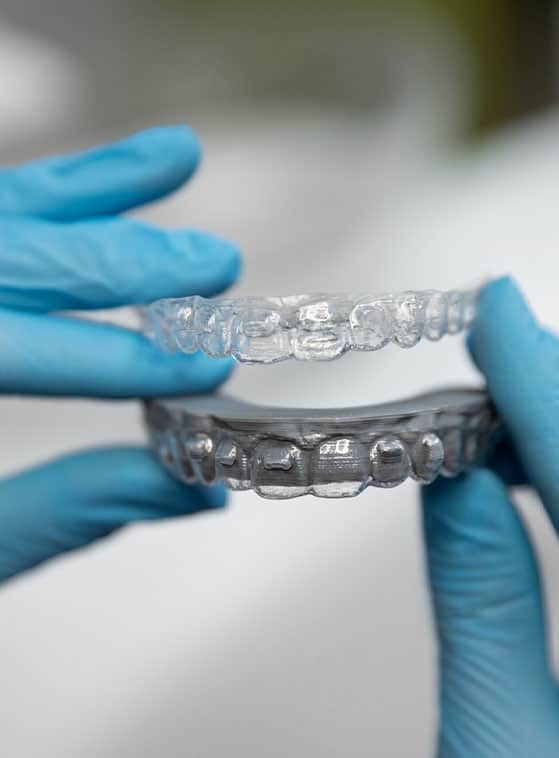 clear aligners, affordable Invisalign treatment in Albania