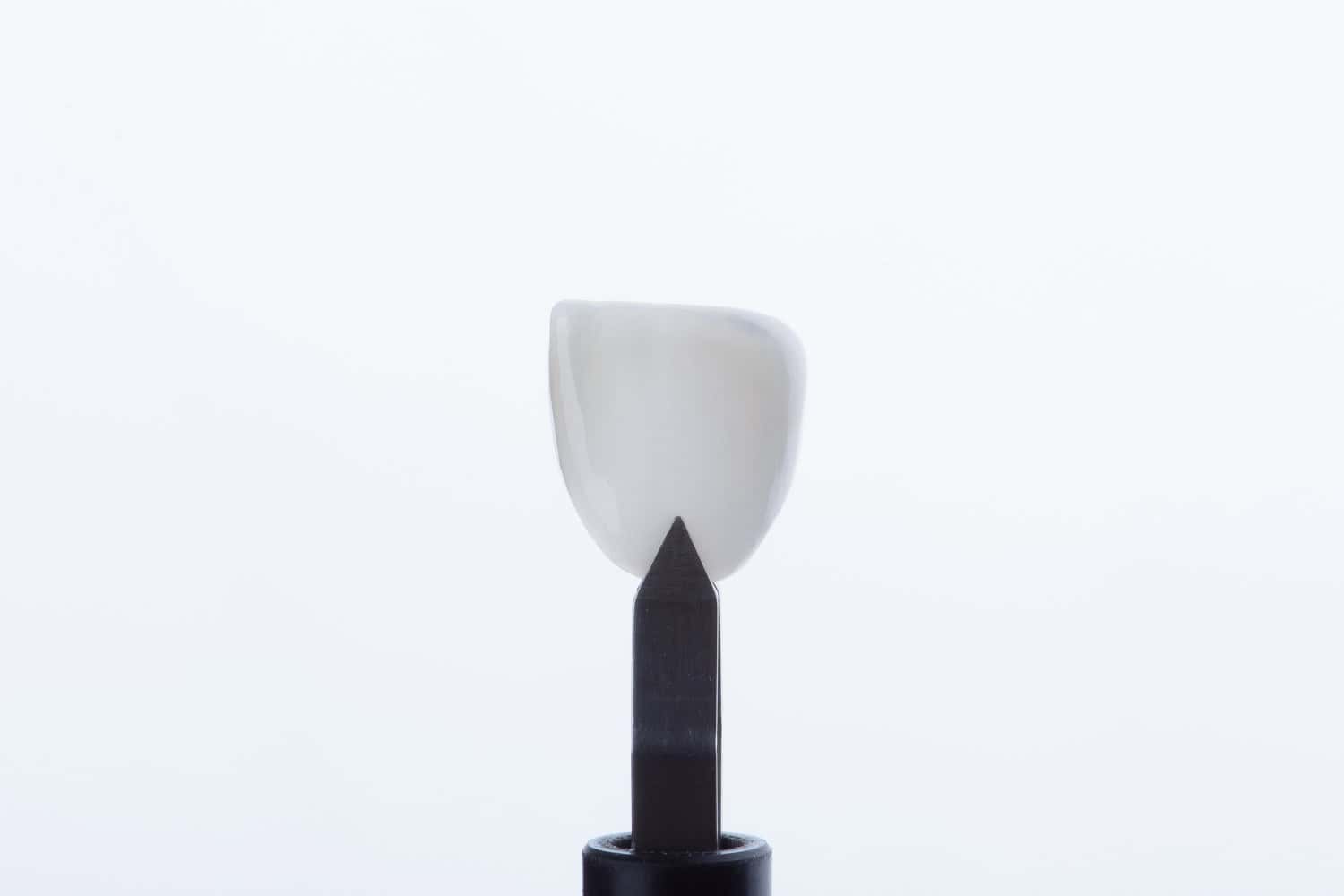 affordable dental veneers in Albania