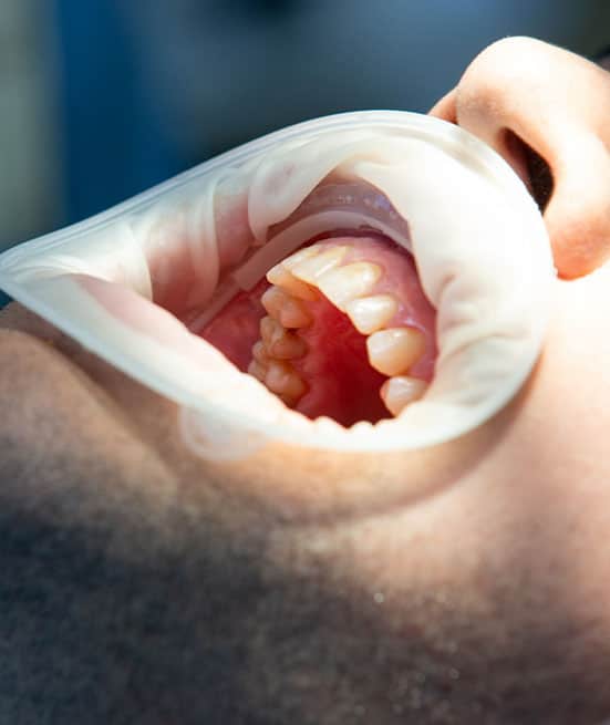 preventative gum disease treatment in Albania