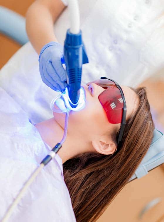 quick and safe professional teeth whitening in Albania